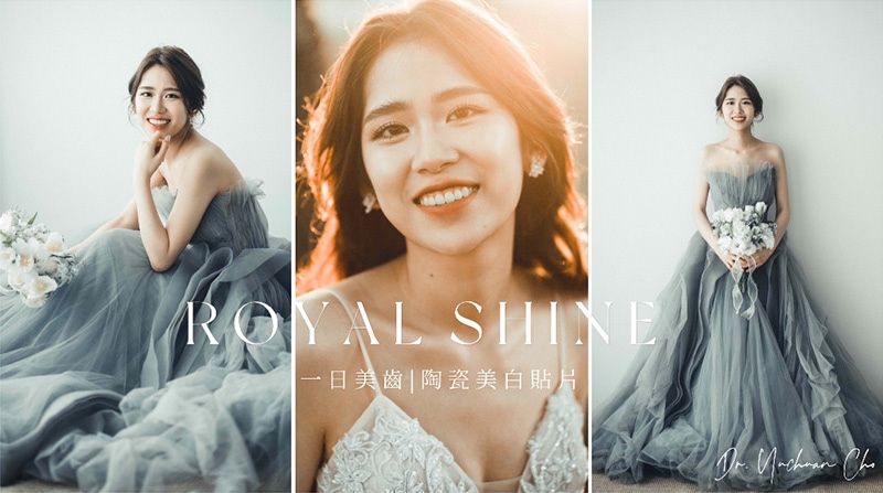 台北新娘張小姐的婚紗照，台中全瓷冠、陶瓷貼片給她自信又美麗的笑容