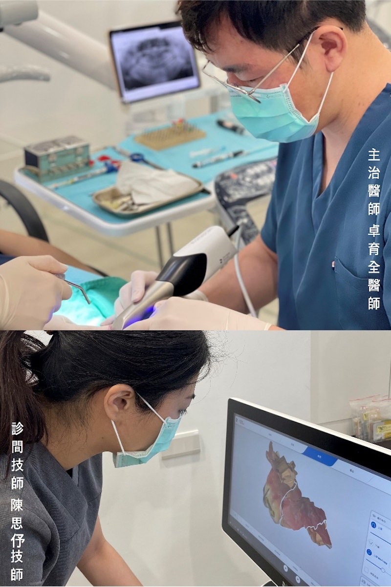 即拔即種與補骨手術五個月後，進行植體穩定度測試與數位全瓷冠假牙的設計製作