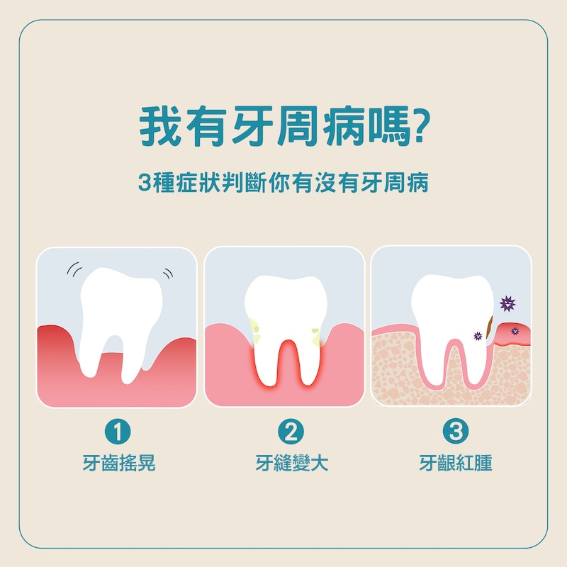 3種牙周病症狀判斷自己是否有牙周病：牙齒搖晃、牙縫變大、牙齦紅腫