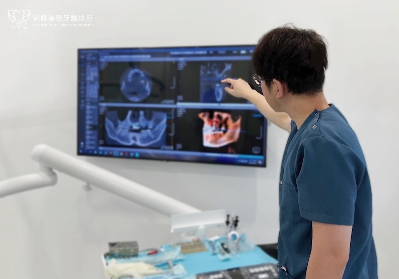 御耀美學卓院長依3D立體影像為台中市潭子區患者黃先生規劃微創植牙治療方式