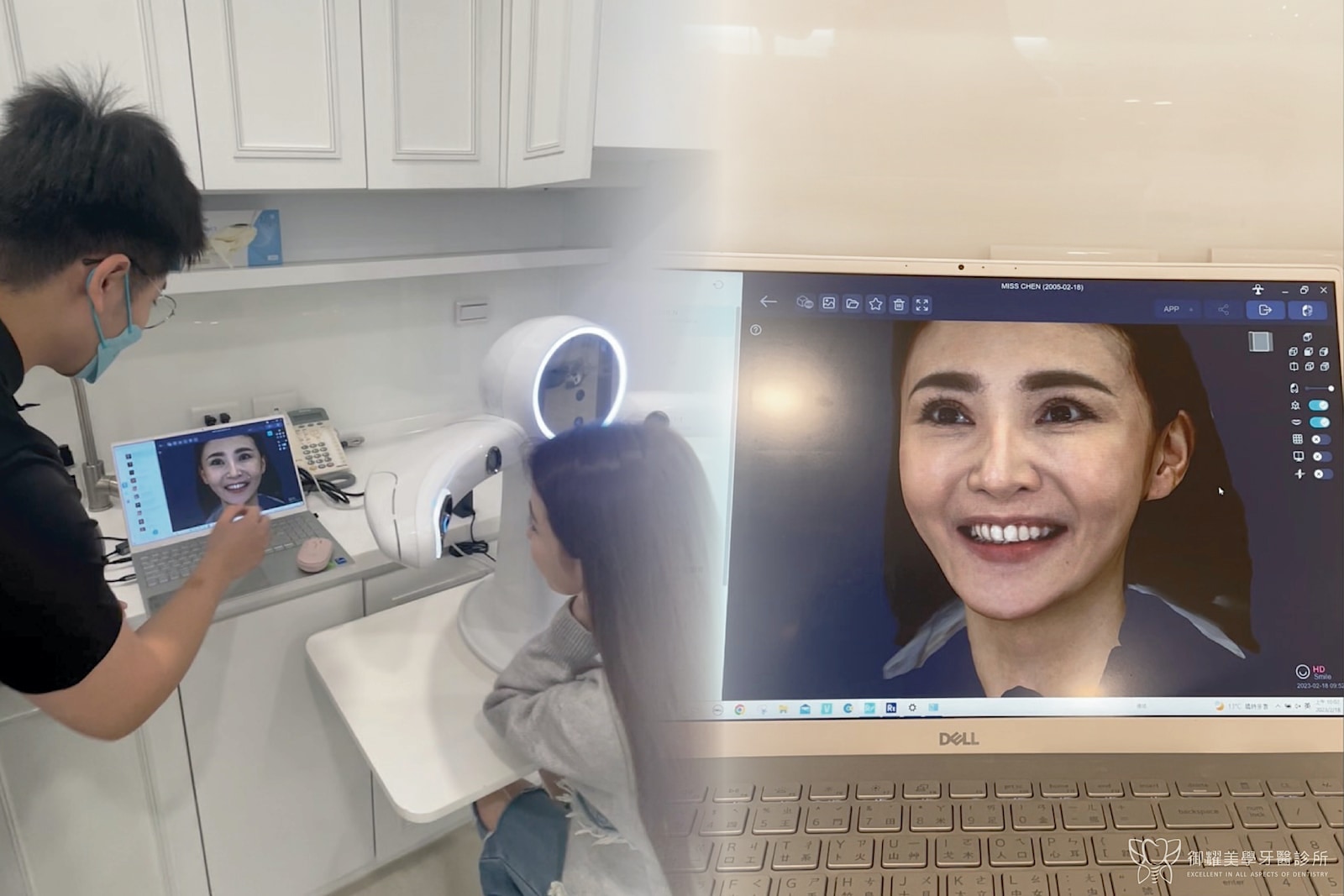 台中御耀美學使用臉部掃描機為明星陳子玄進行陶瓷貼片術前模擬的過程