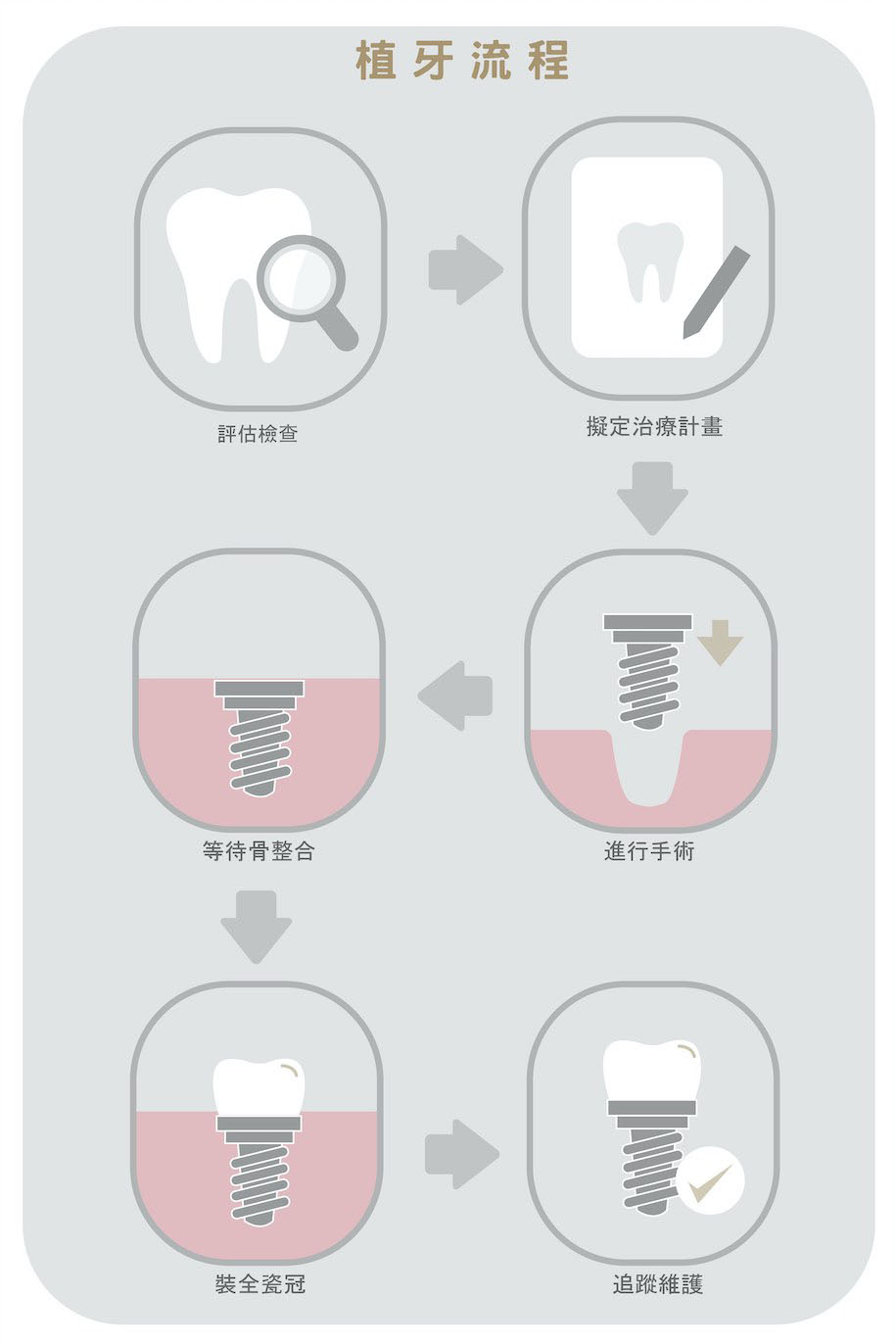 植牙流程示意圖