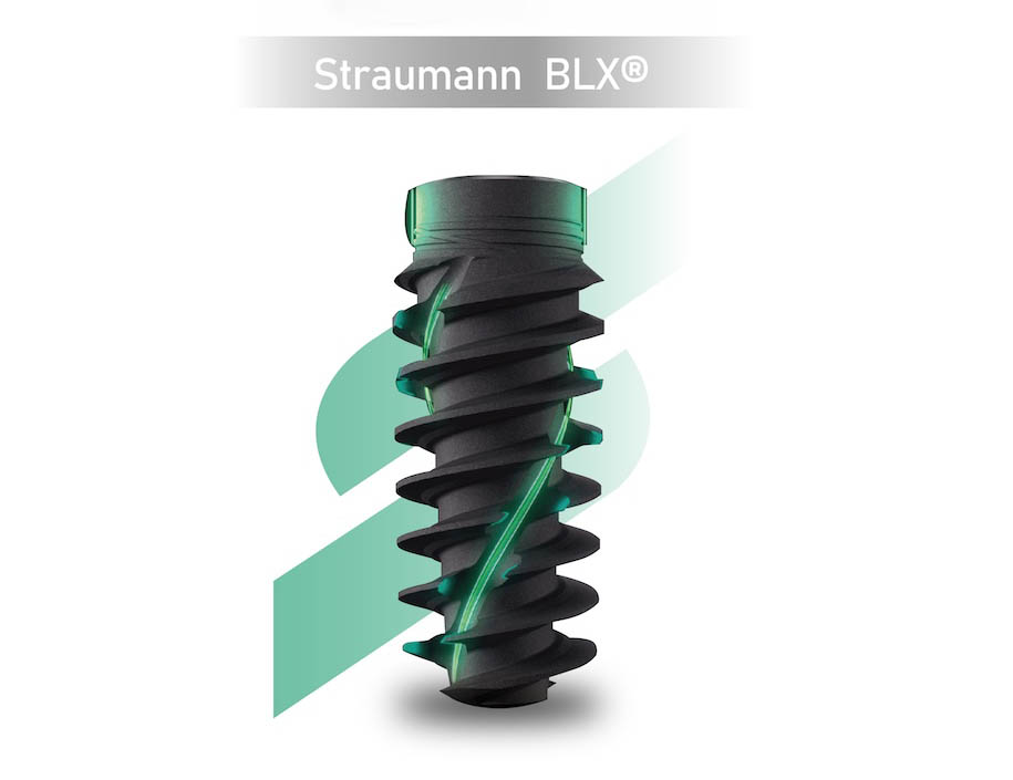 士卓曼Straumann BLX植體