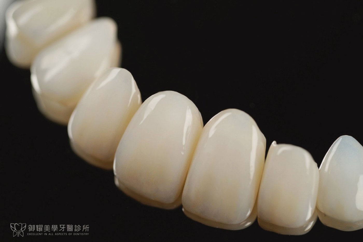 御耀陶瓷貼片特寫,呈現自然透亮的色澤與立體層次