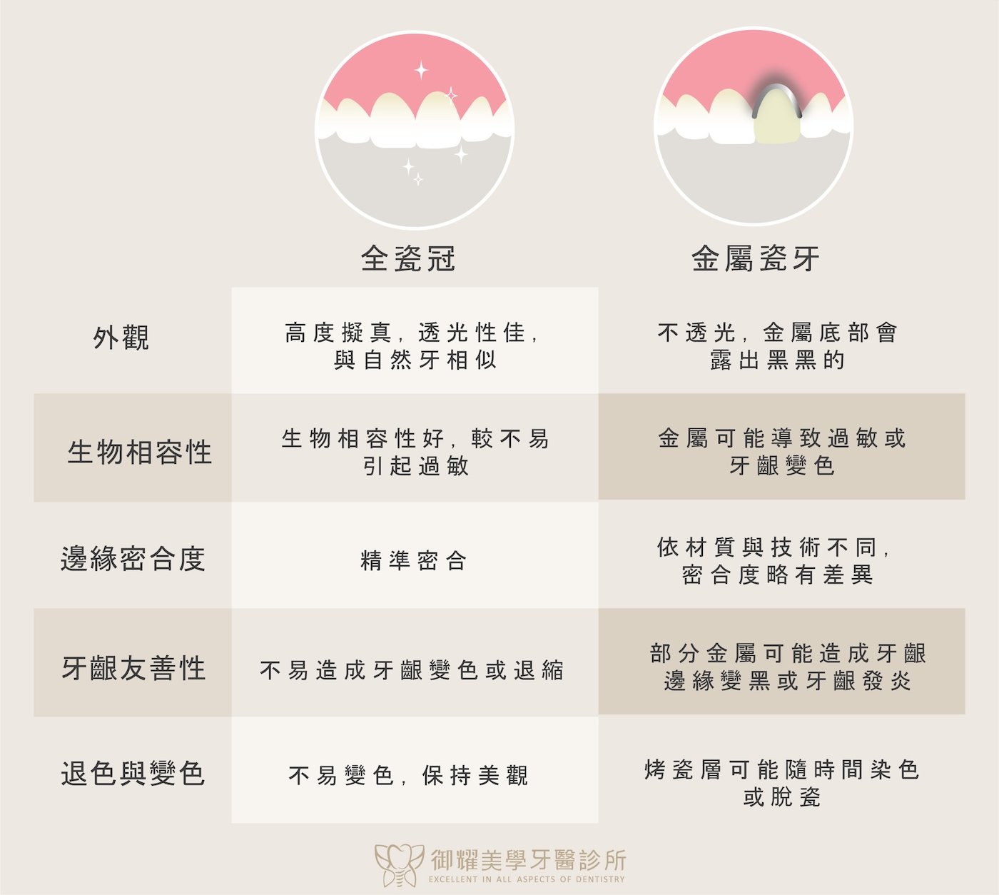 全瓷冠與金屬瓷牙（烤瓷牙）比較圖，說明外觀、生物相容性、密合度、牙齦友善性與退色變色等差異