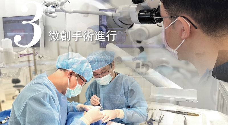 植牙療程步驟3：微創手術進行