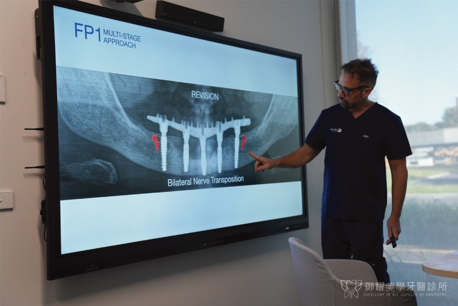 Dr. Alex Fibishenko 講解 All-on-4 植牙術後影像與臨床設計重點