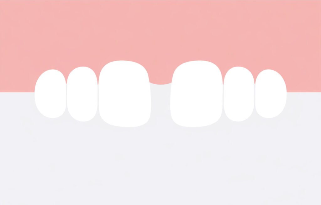 牙縫大-門牙有縫-原因-補救-關牙縫-台中牙醫推薦-御耀美學牙醫
