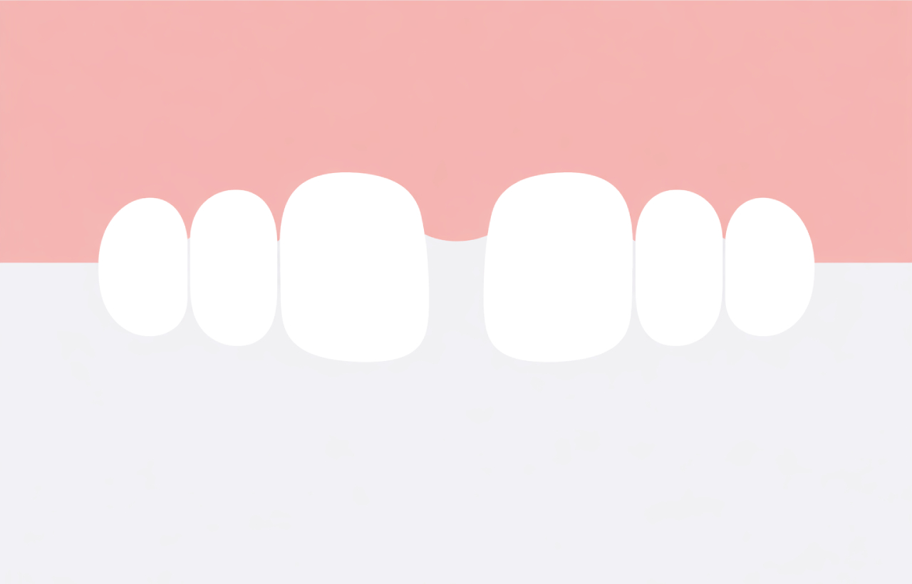 牙縫大-門牙有縫-原因-補救-關牙縫-台中牙醫推薦-御耀美學牙醫