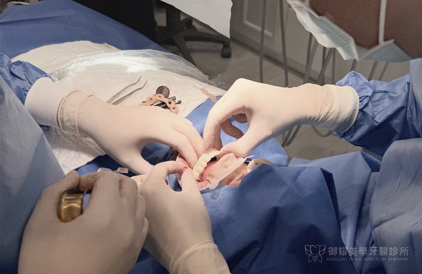全口重建手術中裝戴臨時固定式假牙示意圖