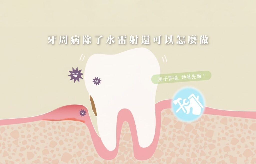 牙周再生凝膠-台中牙周病治療-推薦-御耀美學牙醫