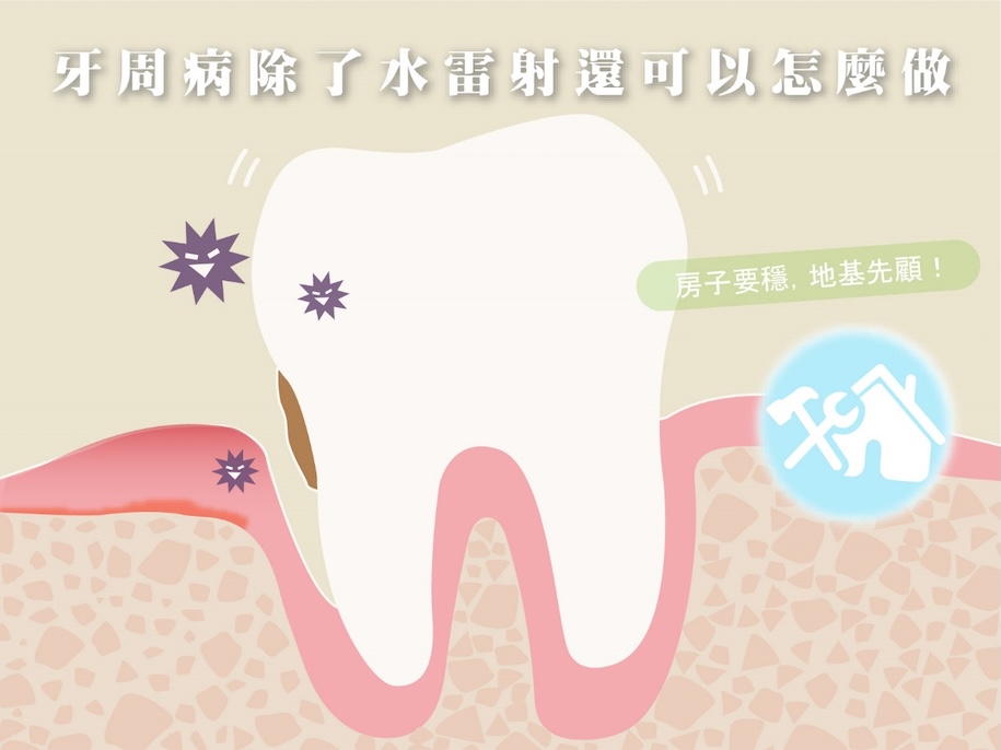 牙周病牙齒地基示意圖