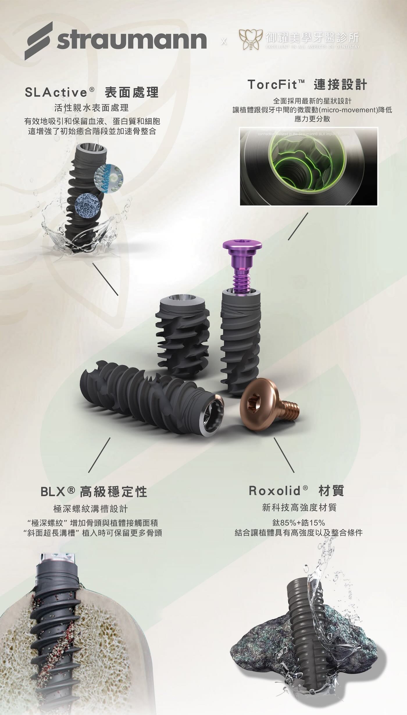 士卓曼BLX植體設計與材料特色介紹