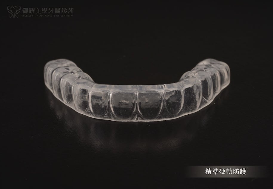 睡覺磨牙使用的客製化咬合板 Night Guard