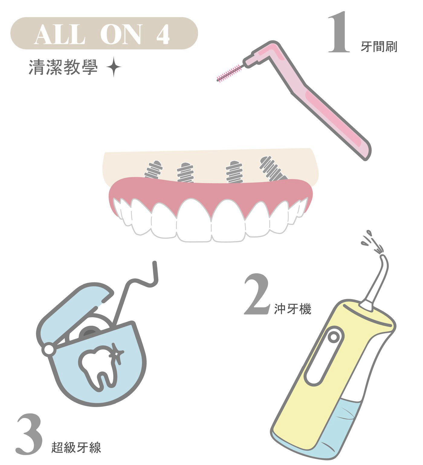 All-on-4固定式假牙清潔方式示意圖