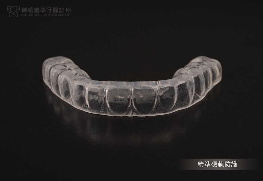 睡覺磨牙使用的客製化咬合板 Night Guard