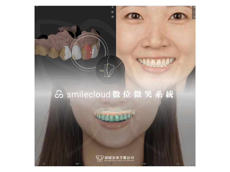 Smilecloud 數位微笑設計